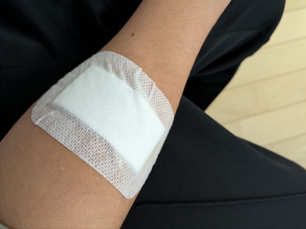 猫に噛まれ、ガーゼで処置された腕